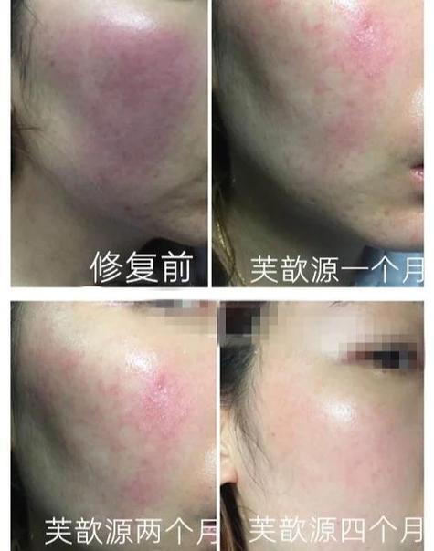 脸删了怎么快速恢复