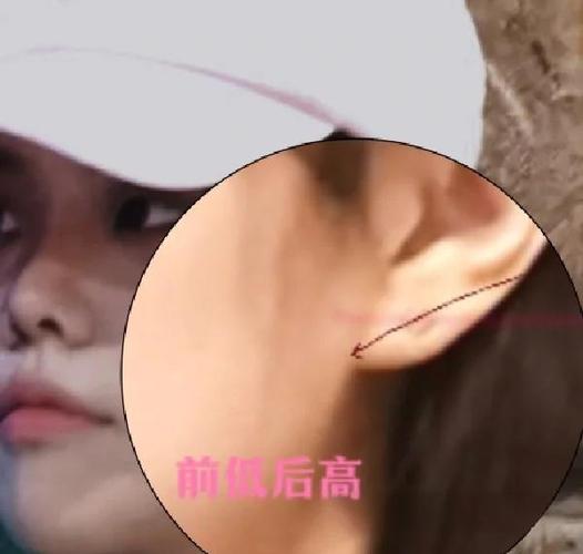 打耳骨位置示意图图标