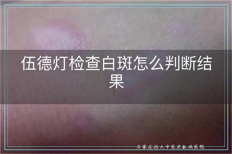 11屏幕出现白斑的原因缩略图