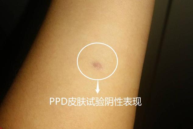 手机拍照光面有小红点