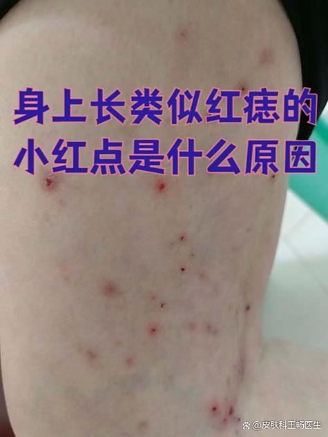 身上有突出的小红点是怎么回事