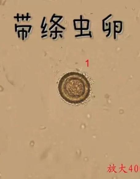 田螺煮熟了还有寄生虫吗