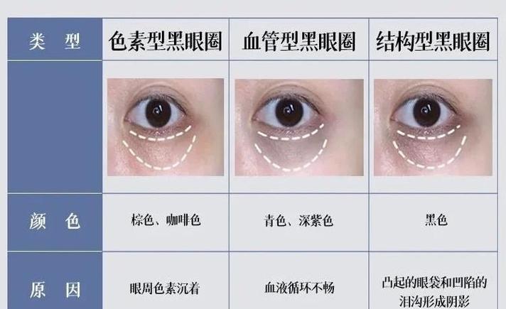祛黑眼圈挂什么科