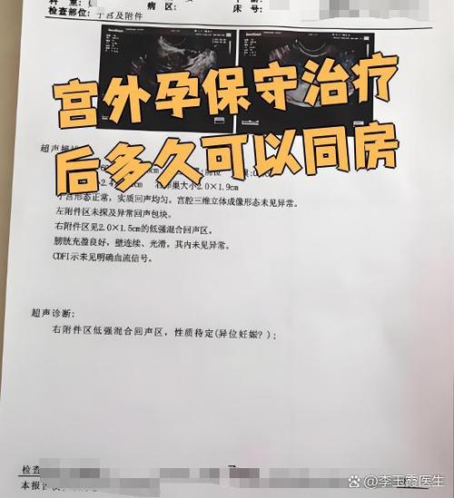 宫外孕打mtx多久见效游戏截图
