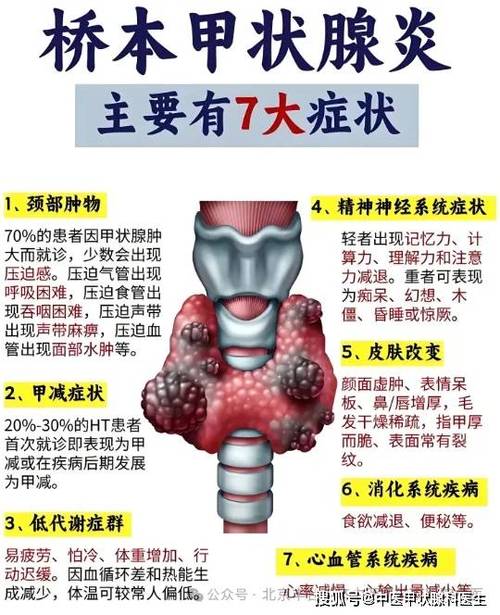 桥本病有什么症状缩略图