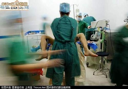 美女变性成男人手术图标