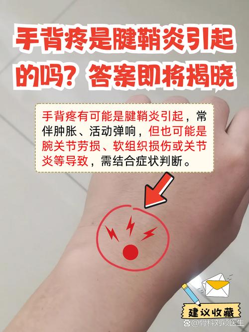 手背痛要当心三种病
