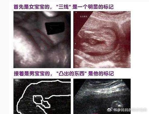 怎么知道男女宝宝性别截图