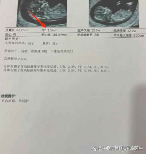 预约nt需要带什么