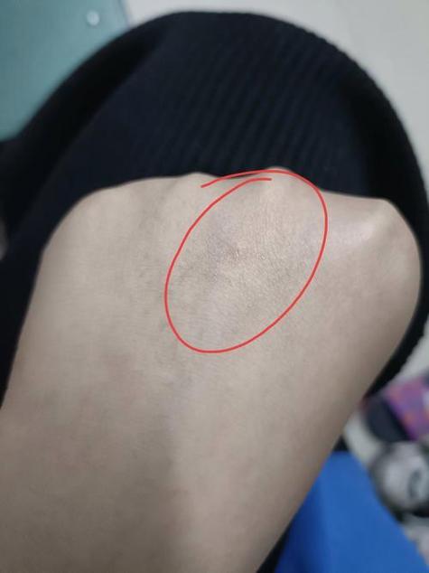 猫抓的痕迹多久能消缩略图