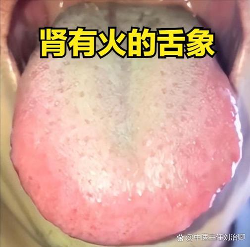 小儿口干口臭流鼻血