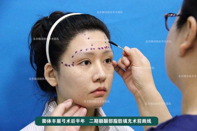 做眉弓的10个忠告