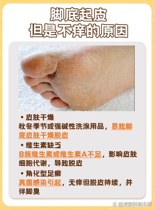 脚底板痒怎么办