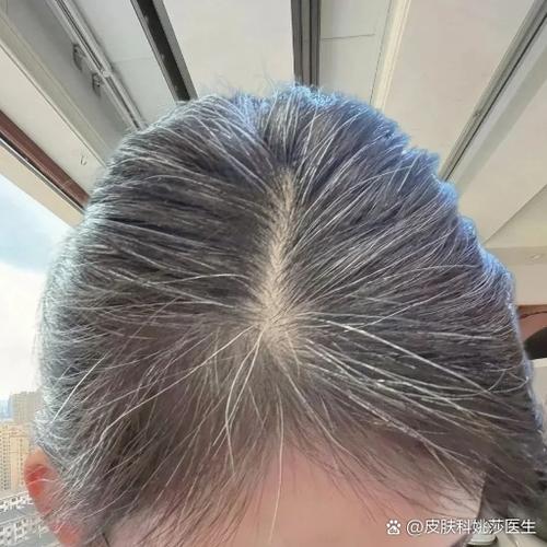 手机人物头发变成白色