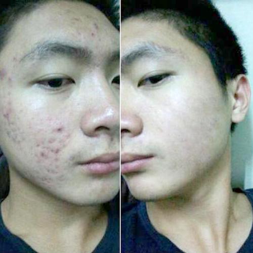 豆豆怎么样才能消得快