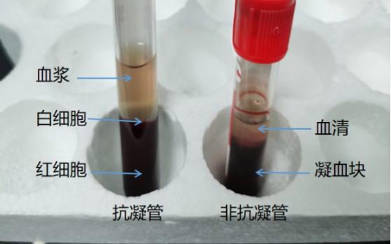 eb病毒dna血清和血浆的区别截图
