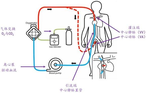 exmo治疗