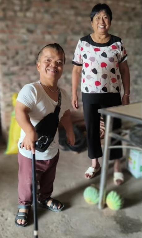 侏儒长什么样子图片