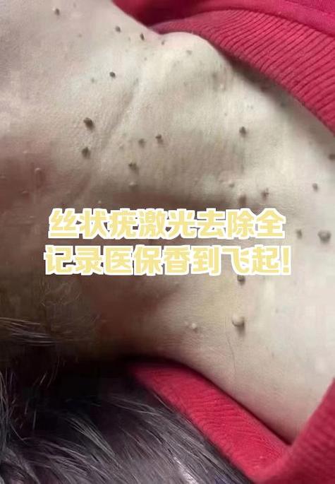 皮肤科做激光可以用医保吗