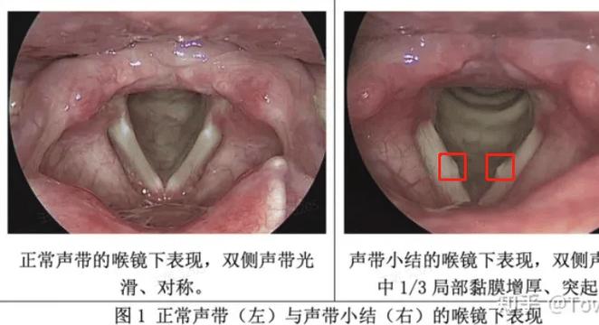 普通人怎么开嗓子截图