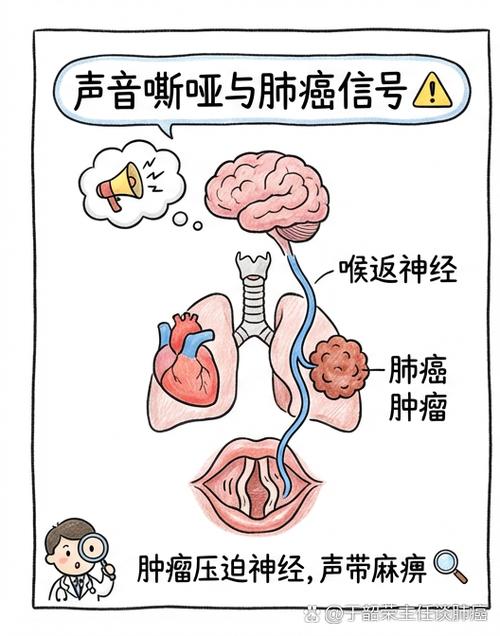 喉咙说话声音变了是怎么回事
