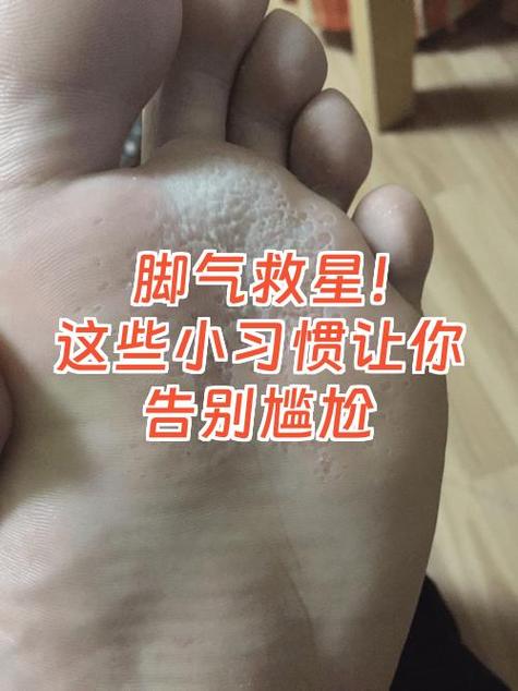 脚底痒