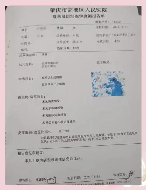 hpv真假查询