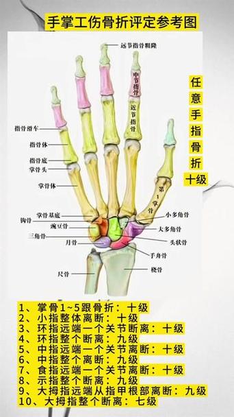 掌骨骨折算几级伤残缩略图