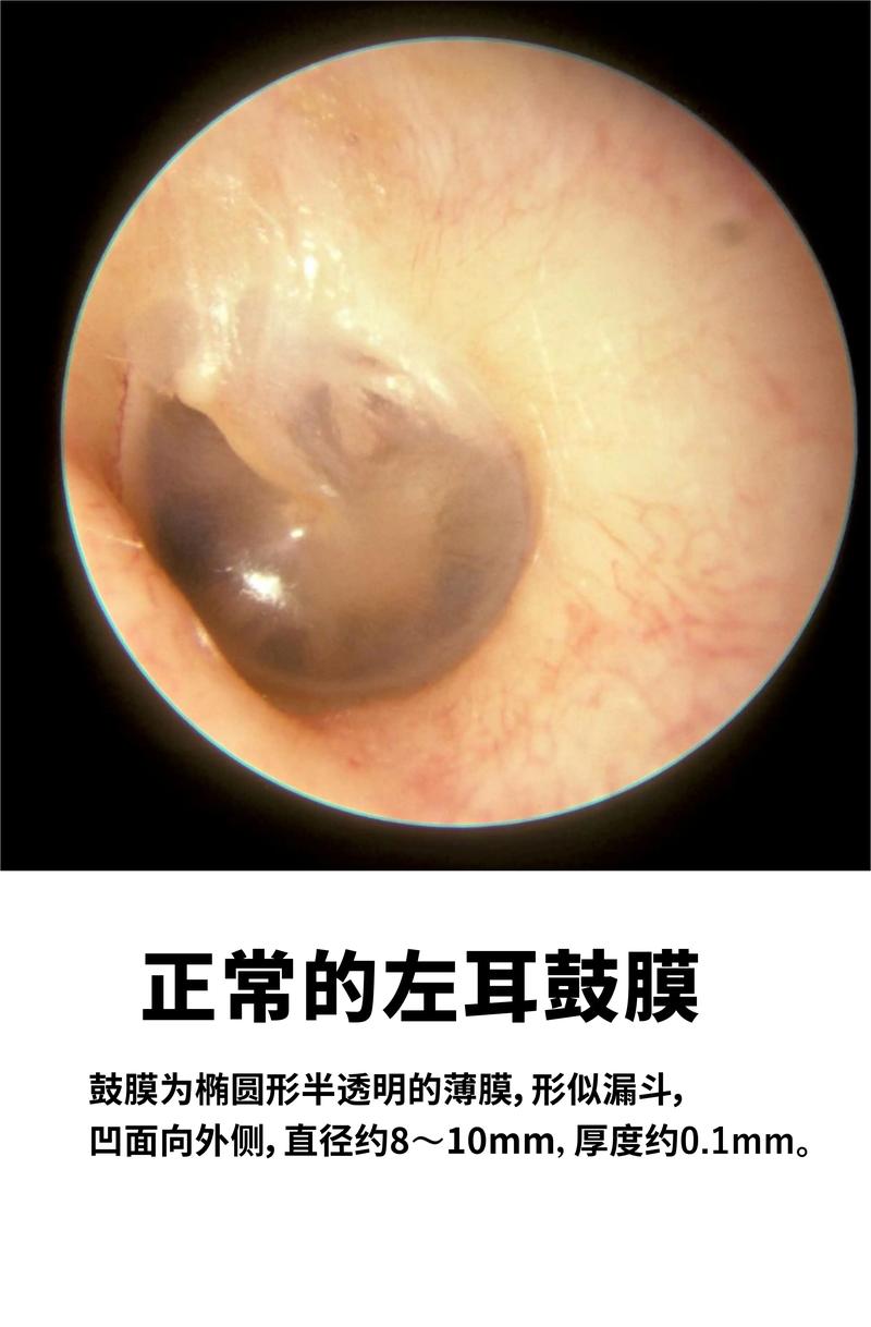 耳朵里像打鼓
