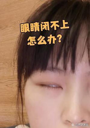 眼睛闭上时眼皮不断抖