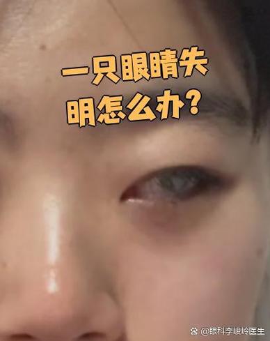 眼睛失明是什么颜色