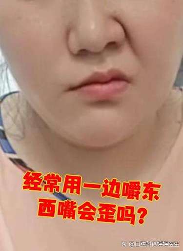 嘴往一边歪怎么回事