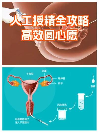 人工授精需要多长时间能完成