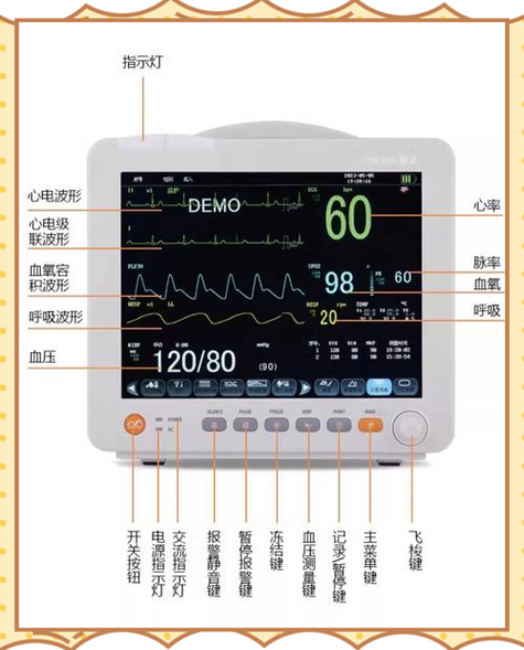 心电监护仪按键功能
