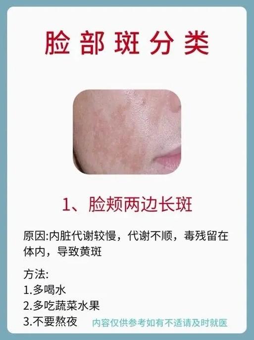 消除斑点的方法