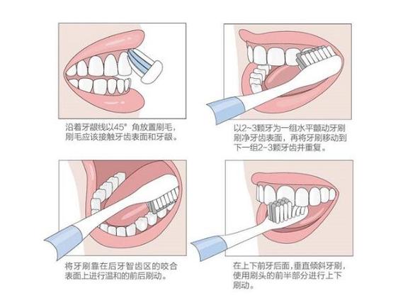 电动牙刷刷牙正确的示范