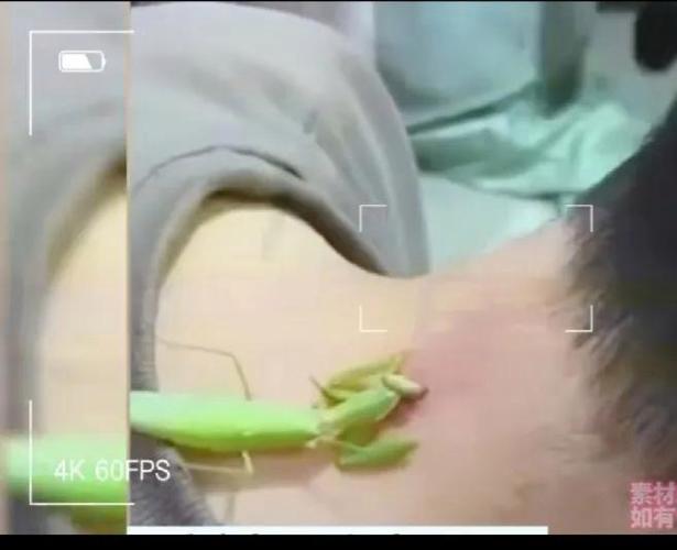 嘴挂钩掉了合不上嘴怎么办