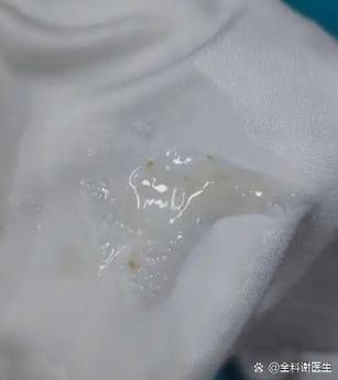 咳嗽出一坨一坨的灰色痰