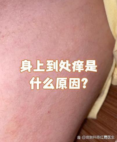为什么身上老是痒
