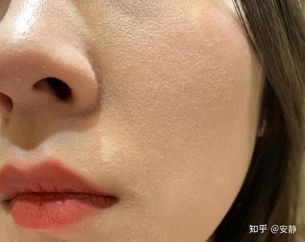 什么叫做卡粉