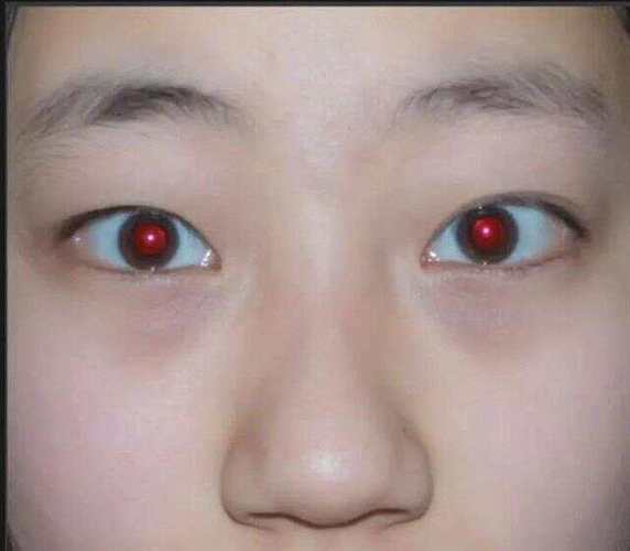 相机红眼是什么意思