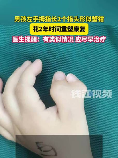 双指是什么意思图标
