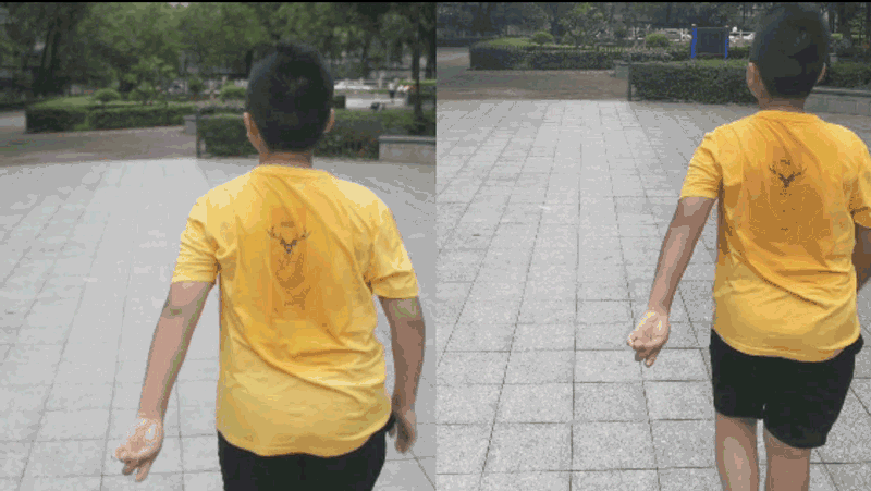 走路一左一右晃是为什么截图