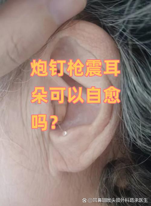 炮钉枪震的耳朵一直响怎么办