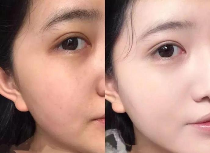 如何美白皮肤缩略图