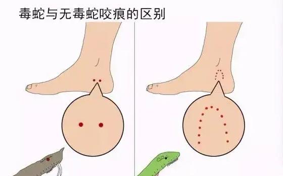 蝰蛇咬人伤口图片