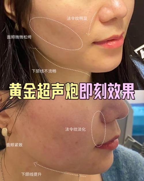 黄金炮几天能看出效果啊