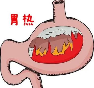 口渴口干怎样解决