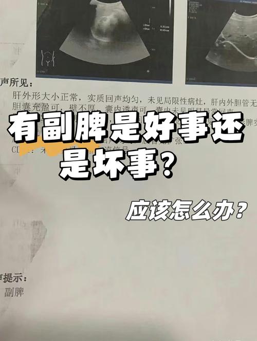 待复审是好事还是坏事