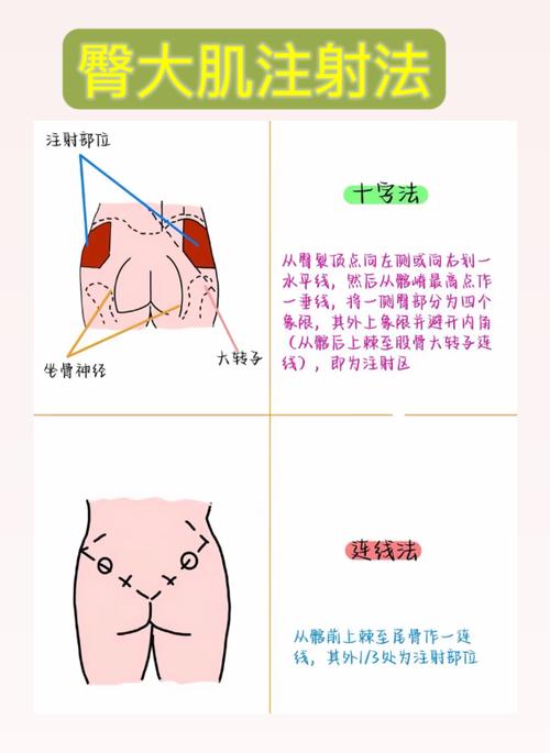 打屁股针两边都打在同一天